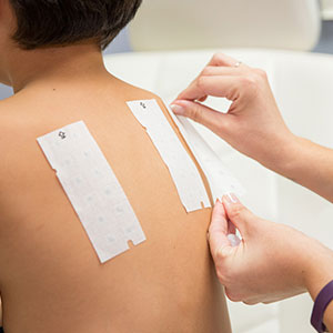 Phoenix Dermatologist applying patches to patients back to test for allergies