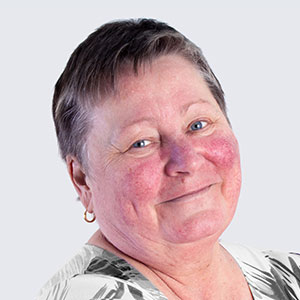 Woman with rosacea on her cheeks smiling before speaking with her Phoenix Dermatologist at Saguaro Dermatology